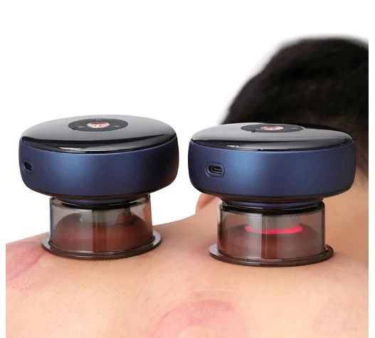 Electric Vacuum Cupping Massager with Heat Therapy – Smart Pain Relief & Muscle Relaxation Device